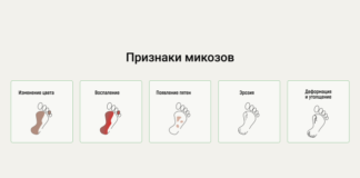Почему чешутся стопы: грибок или просто усталость ног?